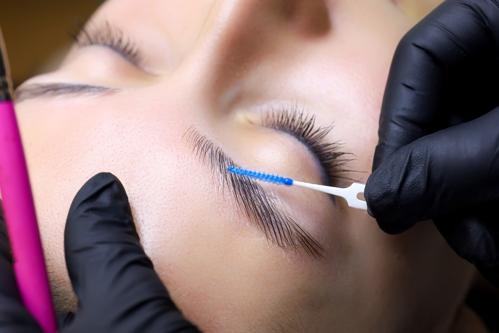 Everything you need to know about brow lifts